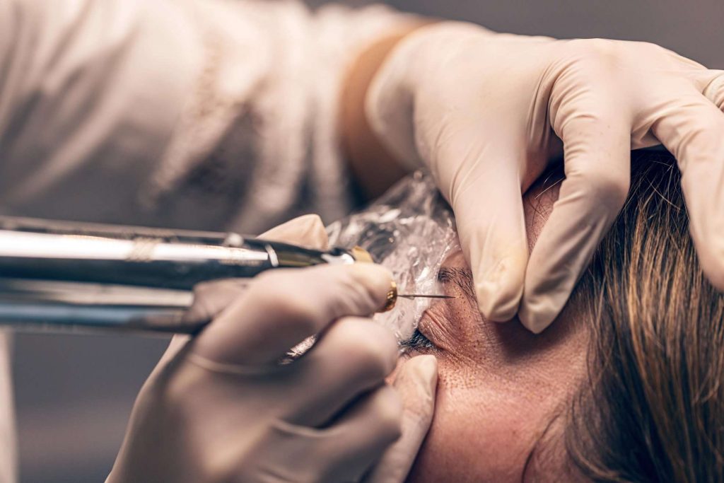 overview of blepharoplasty