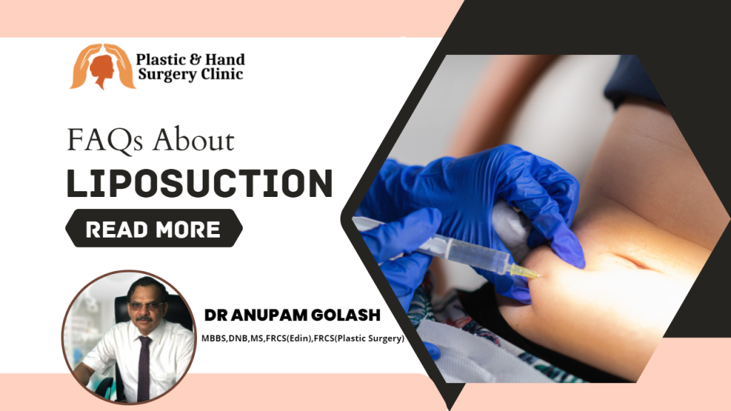 FAQs About Liposuction