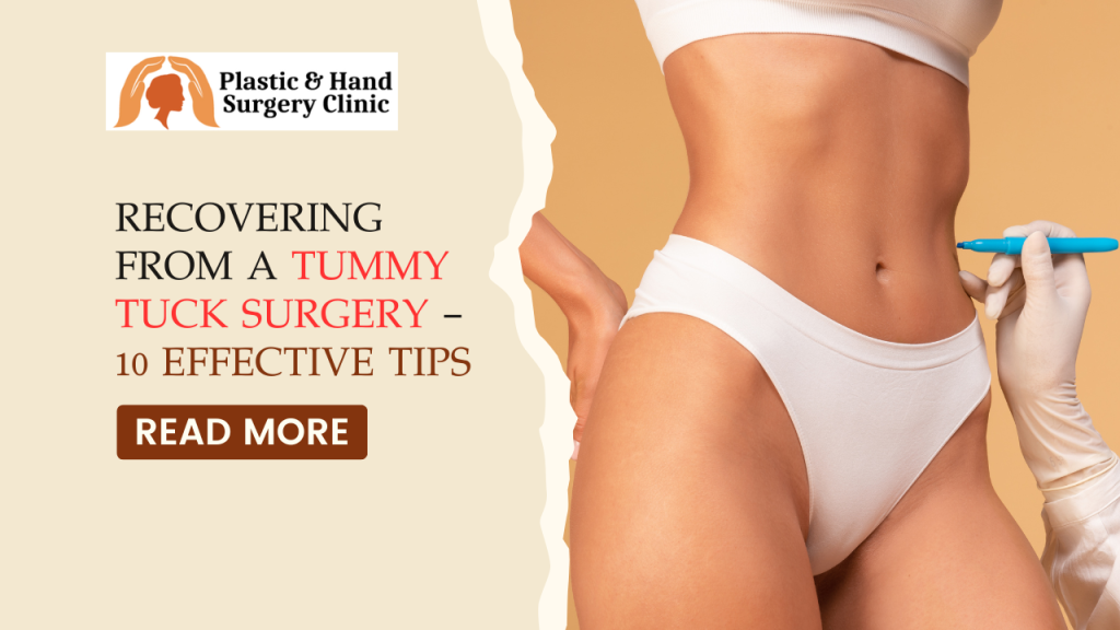 Recovering From A Tummy Tuck Surgery
