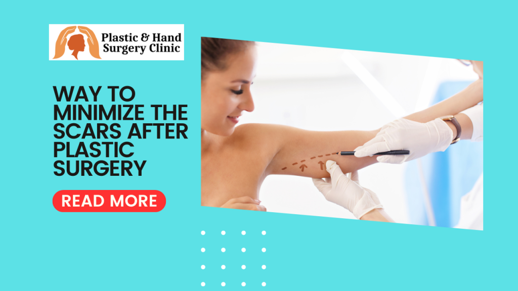 Way To Minimize The Scars After Plastic Surgery