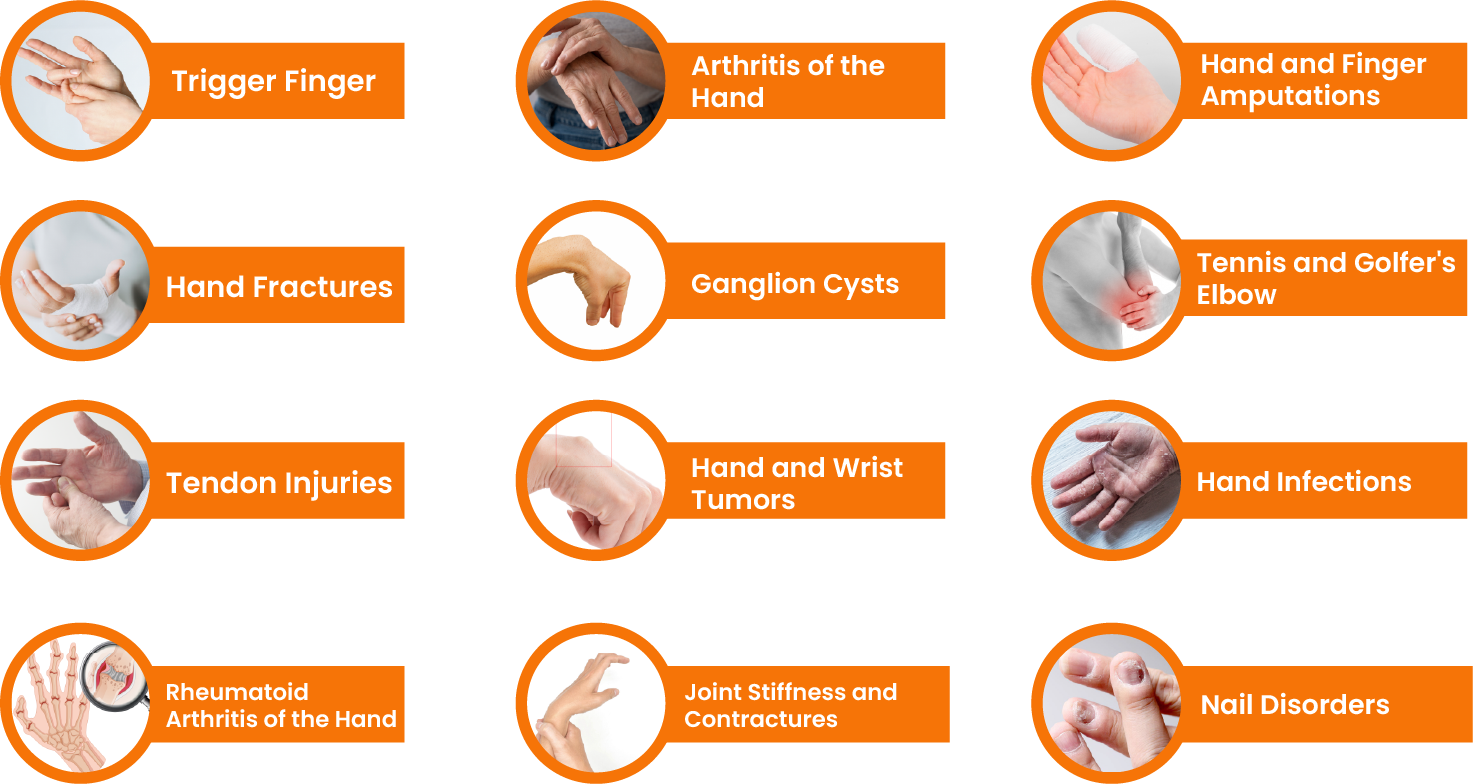 Best Plastic Hand Surgery Kolkata Dr Anupam Golash