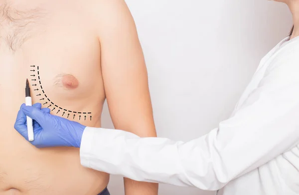 depositphotos_327931556-stock-photo-the-doctor-plastic-surgeon-marks