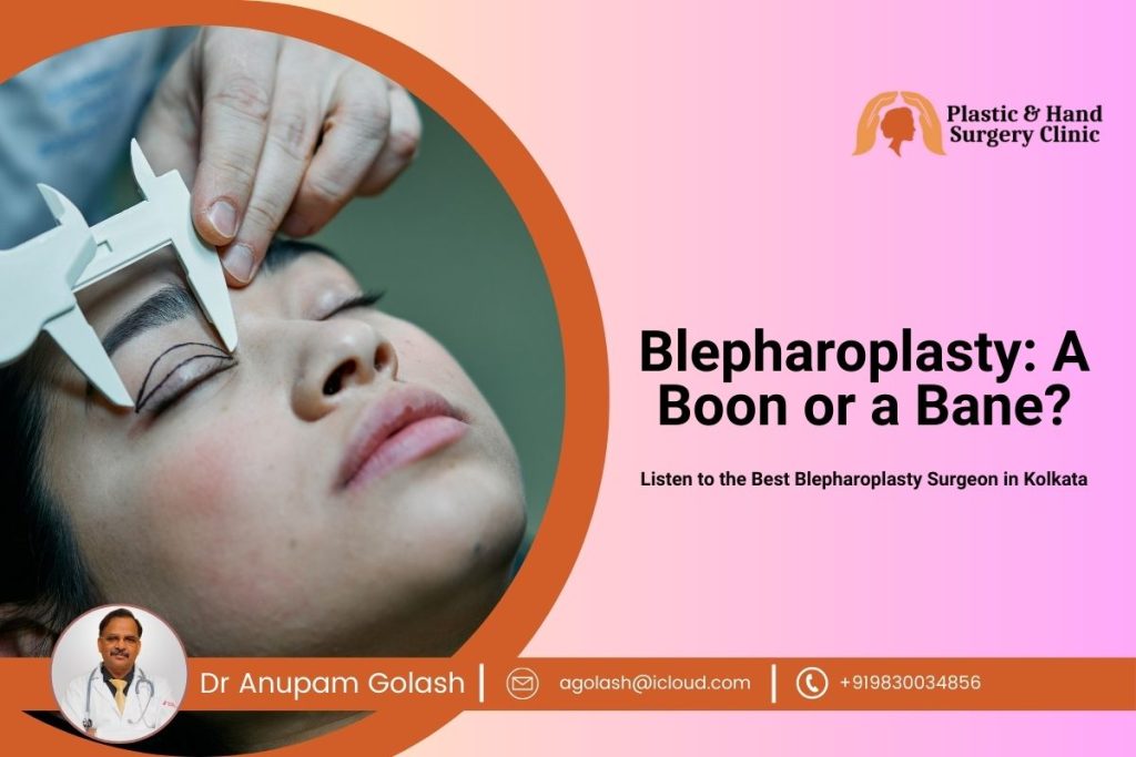 Blepharoplasty: A Boon or a Bane? – Listen to the Best Blepharoplasty Surgeon in Kolkata