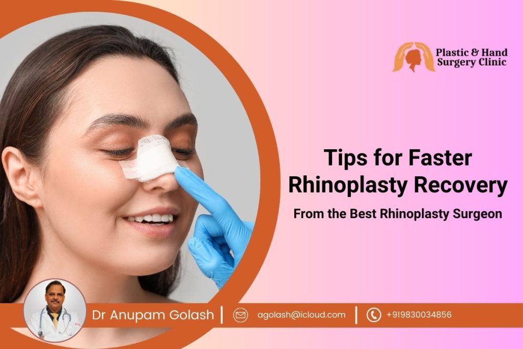 Tips for Faster Rhinoplasty Recovery from the Best Rhinoplasty Surgeon