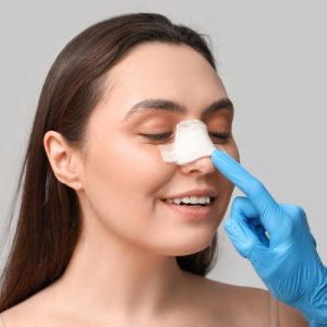 Rhinoplasty