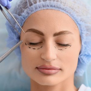 Eyelid Surgery