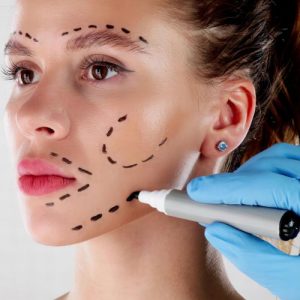 Facial Fat Grafting