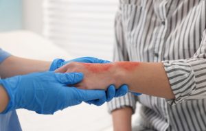 Recovery After Trauma or Cancer Treatment
